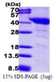 Human GNAI1 protein, His tag. GTX67419-pro
