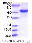 Human GNAQ protein, His tag. GTX67422-pro