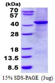 Human GNAZ protein, His tag. GTX67423-pro