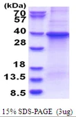 Human GNB1 protein, His tag. GTX67424-pro