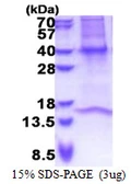 Human GNB3 protein, His tag. GTX67425-pro