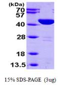 Human GOT1 protein, His tag. GTX67426-pro