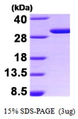 Human 14-3-3 sigma protein. GTX67427-pro