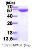 Human GPI protein, His tag. GTX67429-pro
