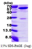 Human GPT protein, His tag. GTX67430-pro