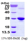 Human GPX1 protein, His tag. GTX67431-pro