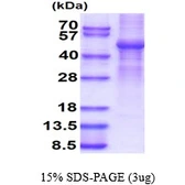 Human GSK3 beta protein, His tag. GTX67434-pro