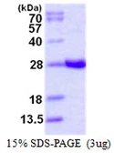 Human GSTA4 protein, His tag. GTX67437-pro