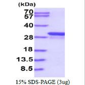 Human GSTT1 protein, His tag. GTX67442-pro