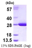 Human GSTT2 protein, His tag. GTX67443-pro