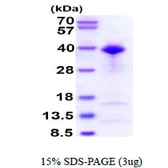 Human TFIIB protein, His tag. GTX67444-pro