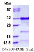 Human TFIIE beta protein, His tag. GTX67445-pro
