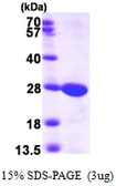 Human Guanylate kinase protein, His tag. GTX67447-pro