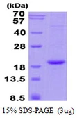 Human Hemoglobin alpha 2 protein, His tag. GTX67452-pro
