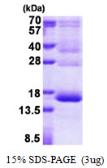Human Hemoglobin gamma A protein, His tag. GTX67453-pro
