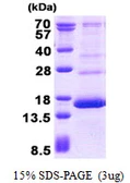 Human Hemoglobin gamma 2 protein, His tag. GTX67454-pro