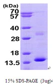 Human Hemoglobin zeta protein, His tag. GTX67456-pro