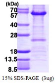 Human HDAC2 protein, His tag. GTX67457-pro