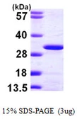 Human HIP2 protein, His tag. GTX67459-pro