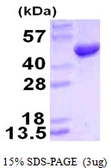 Human HMBS protein, His tag. GTX67463-pro