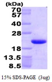 Human HMG14 protein, His tag. GTX67466-pro