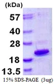 Human HMGA1 protein, His tag. GTX67468-pro
