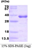 Human HNMT protein, His tag. GTX67469-pro