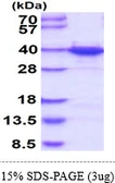 Human hnRNP A1 protein, His tag. GTX67470-pro