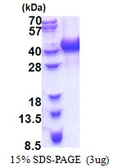 Human hnRNP AB protein, His tag. GTX67471-pro