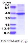 Human HOXA9 protein, His tag. GTX67473-pro