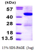 Human HPD protein, His tag. GTX67476-pro