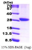 Human 15-PGDH protein, His tag. GTX67477-pro