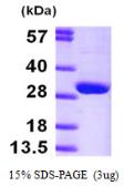 Human HPRT protein, His tag. GTX67478-pro