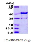 Human HSD17B1 protein, His tag. GTX67480-pro