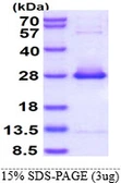 Human HSPB2 protein, His tag. GTX67488-pro