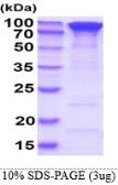 Human Hsp90 alpha protein, His tag. GTX67489-pro