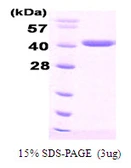 Human Hsp40 protein, His tag. GTX67492-pro