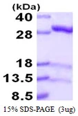 Human IDI1 protein, His tag. GTX67496-pro