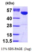 Human IMPDH1 protein, His tag. GTX67501-pro