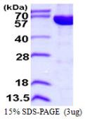 Human IMPDH2 protein, His tag. GTX67502-pro