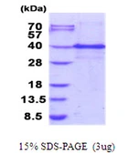 Human ING1 protein, His tag. GTX67504-pro