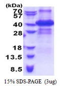 Human ING2 protein, His tag. GTX67505-pro