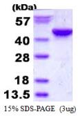 Human ITPK1 protein, His tag. GTX67507-pro