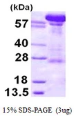 Human Importin beta 1 protein, His tag. GTX67509-pro