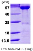 Human KPNA2 protein, His tag. GTX67510-pro