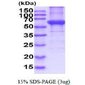 Human Cytokeratin 5 protein, His tag. GTX67511-pro