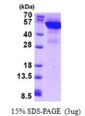 Human Cytokeratin 8 protein, His tag. GTX67512-pro
