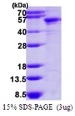 Human Cytokeratin 14 protein, His tag. GTX67513-pro
