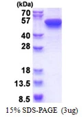 Human Cytokeratin 16 protein, His tag. GTX67514-pro