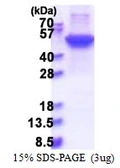 Human Cytokeratin 17 protein, His tag. GTX67515-pro